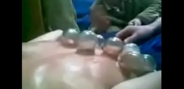  army guy forced for fire cupping